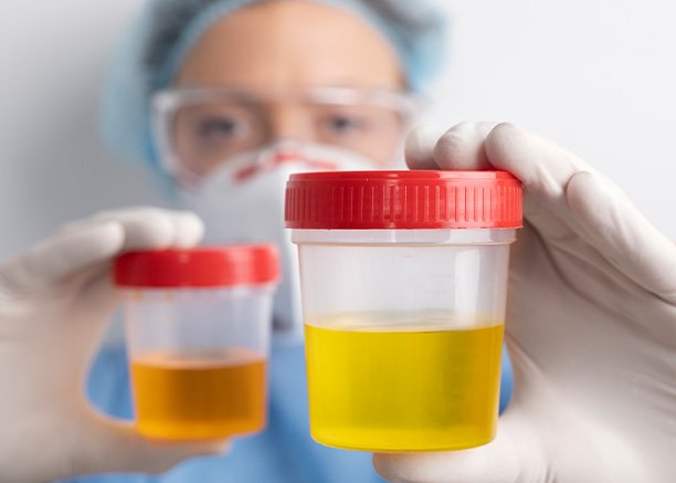 Diagnosis and Evaluation